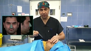 زاویه سازی صورت، جراحی لاله گوش و بینی | دکتر یحیوی