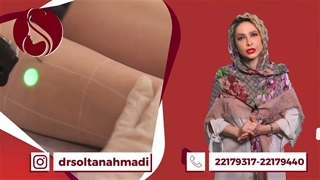 فیلم لیزر موهای زائد همراه با توضیحات تکمیلی پزشک متخصص