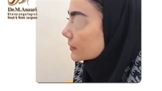 عمل بینی در اردبیل