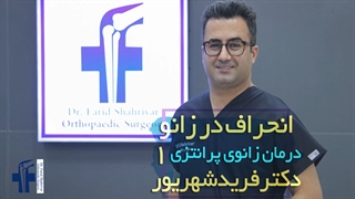 انحراف در زانو | درمان زانوی پرانتزی 1