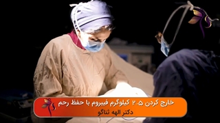جراحی فیبروم 30 سانتی