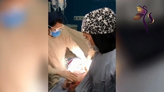 فیلم کامل زایمان سزارین