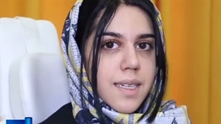 رضایت زیبا جو از جراحی زیبایی بینی