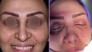 عمل زیبایی بینی توسط دکتر سیدرضا رفیع | جراح بینی تهران