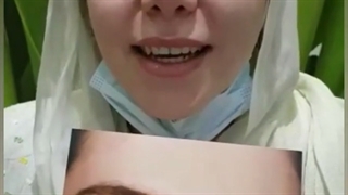 نتیجه جراحی بینی گوشتی