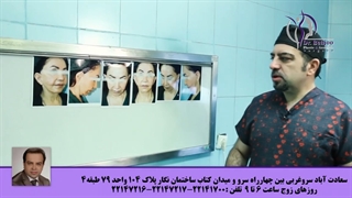 فیلم واقعی جراحی لیفت گردن و صورت در اتاق عمل - پارت سوم