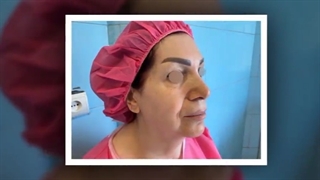 فیلم واقعی جراحی فیس لیفت در اتاق عمل