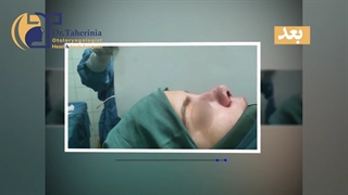 فیلم واقعی جراحی زیبایی بینی