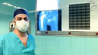 سیاه شدگی سر استخوان ران به دنبال مصرف مواد مخدر صنعتی