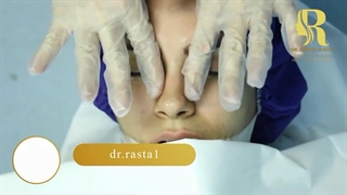 فیلم اتاق عمل جراحی بینی