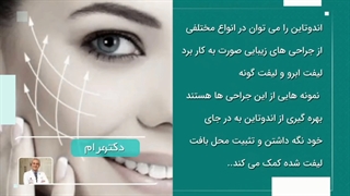لیفت صورت با اندوتاین