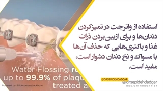 کاربرد واترجت در ارتودنسی | کلینیک دندانپزشکی ایده آل