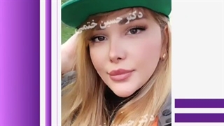 2سال بعد از جراحی بینی