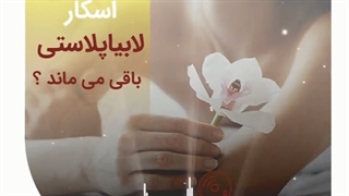 اسکار لابیاپلاستی چقدر باقی می ماند؟