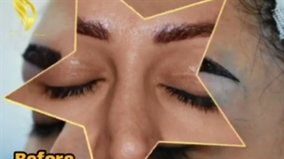 کاشت ابرو، فرصتی برای تغییر