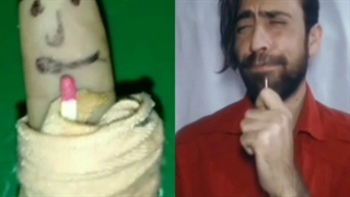 طنز جعفر جراحی گوش