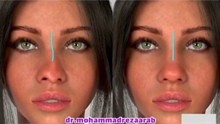 فیلم عمل جراحی زیبایی بینی