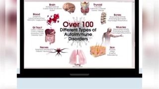 ده زنگ خطر که بیماریهای عیب ایمنی