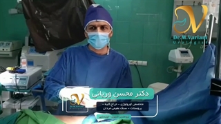 جراحی لاپاراسکوپی جهت درمان تنگی محل اتصال حالب به کلیه