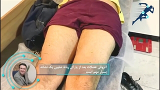 آرتروفى عضلات بعد از پارگى رباط صلیبى