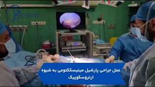 عمل جراحی پارشیل مینیسککتومی به شیوه ارتروسکوپیک