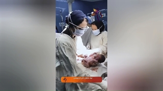 فیلم کامل زایمان سزارین