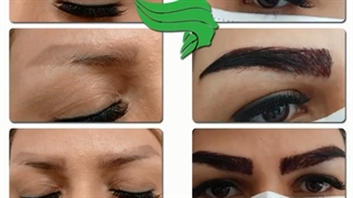 رضایتمندی مشتری عزیزمون از کاشت ابرو