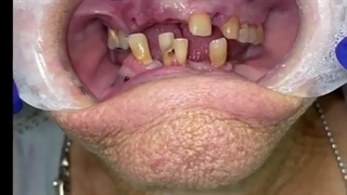 زیبایی دندان