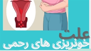 خونریزی های غیر طبیعی رحمی