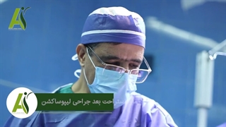 مدت زمان لازم برای استراحت بعد از جراحی لیپوساکشن