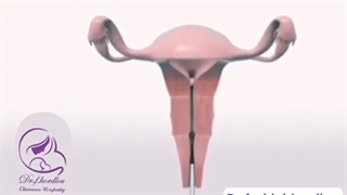 انیمیشن میومکتومی