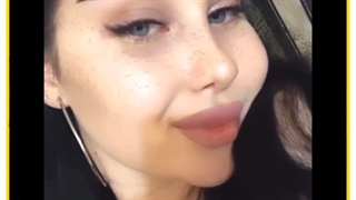 اصلاح نواقص بینی