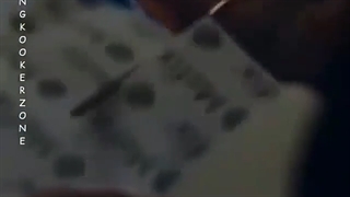 وقتی پای جونگ کوک اسیب دیده بود و بخیه زدن و کوک نمیخواست اعضا متوجه درد اون بشن