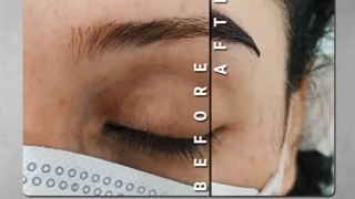 نمونه ای از کاشت ابرو