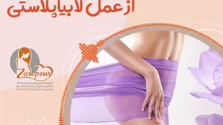 رضایت بیمار از عمل لابیاپلاستی