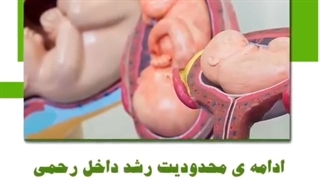 چطور میتونیم تشخیص بدیم که جنین دچار محدودیت رشد داخل رحمی شده یا خیر؟