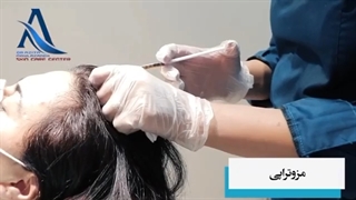 فیلم مزوتراپی موی سر توسط دکتر مولازاده