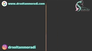 فیلم تزریق بوتاکس پیشانی !!