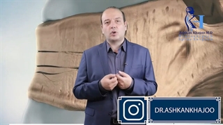 تزریق سیمان در کمر | دکتر اشکان خواجو