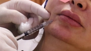 بهترین دکتر برای تزریق فیلر در تهران دندانپزشکی کودکان