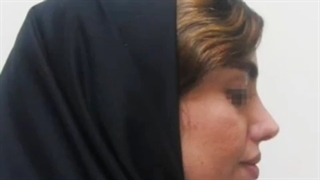 جراحی زیبایی چانه