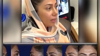 رضایت بعد از عمل زیبایی بینی | متخصص گوش و حلق و بینی | دکتر محمد گلی