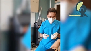 تزریق بوتاکس کف دست و زیربغل جراحی فک