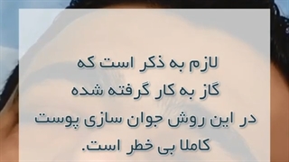 کربوکسی تراپی زیر چشم کلینیک دندانپزشکی