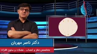 قطع داروی میگرن بدون تحویز پزشک ممنوع!!!