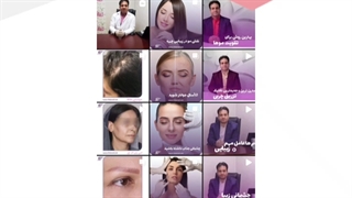 بهترین پیج اینستاگرام تزریق چربی برداشتن خال گوشتی