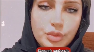 آسیب شنوایی ناشی از صدا