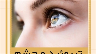 درمان تیروئید چشمی