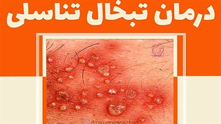 درمان تبخال تناسلی