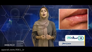 درمان تبخال | داروخانه آنلاین نسخه اول | داروخانه اینترنتی نسخه اول